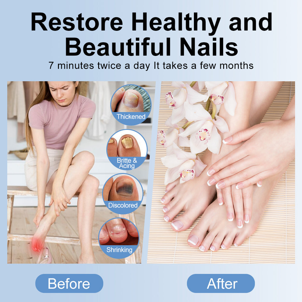Foot Care