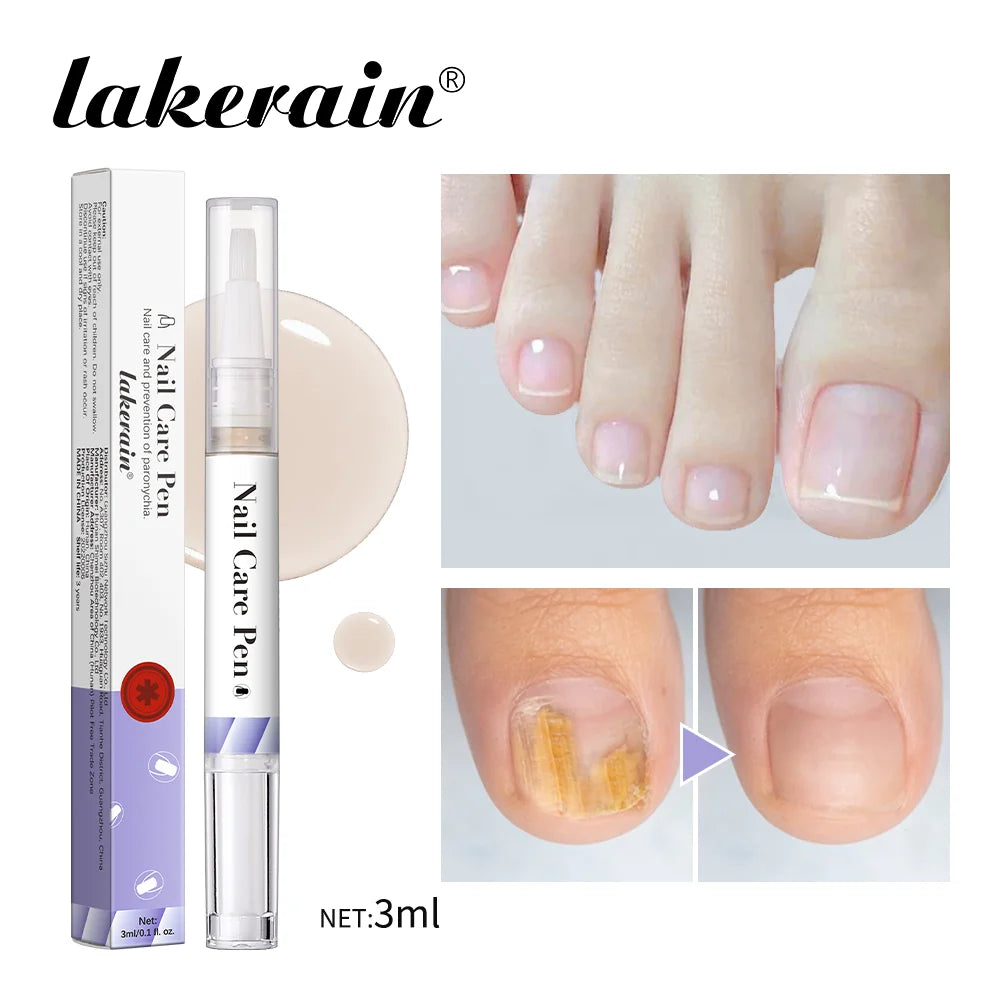 Eleeles Nail Care Pen – Cuticle Oil with Flat Brush, Nourishing & Anti-Fungal 3ml