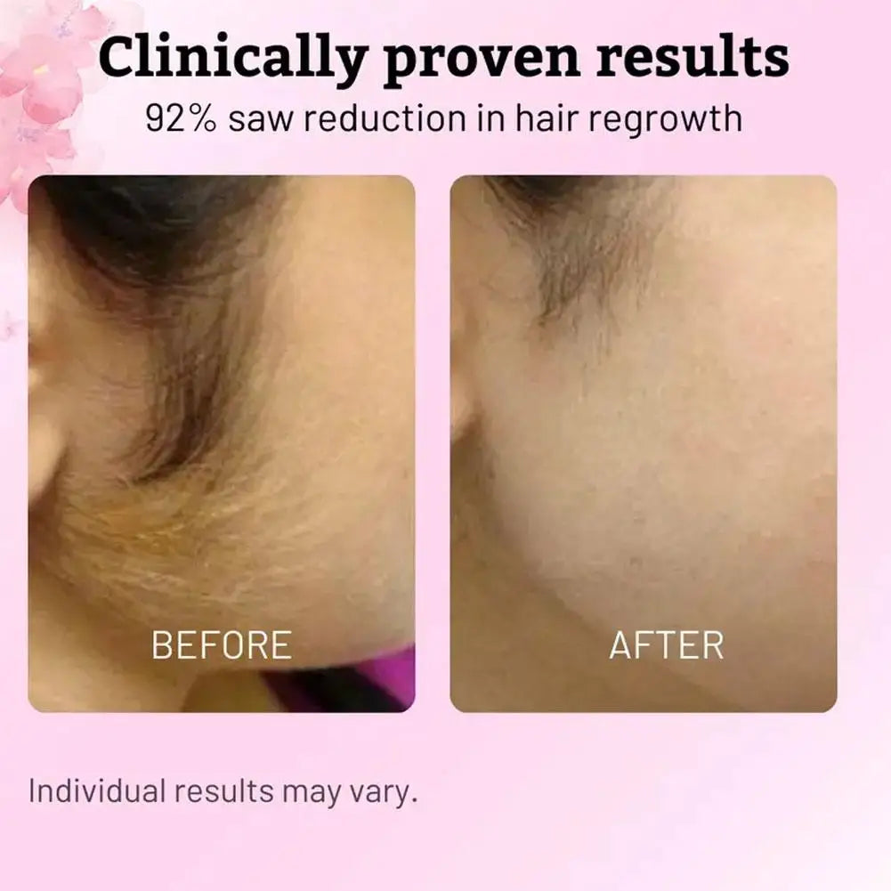 Eleeles After Hair Removal Care Serum – Soothing, Moisturizing & Smooth Skin, 60ml