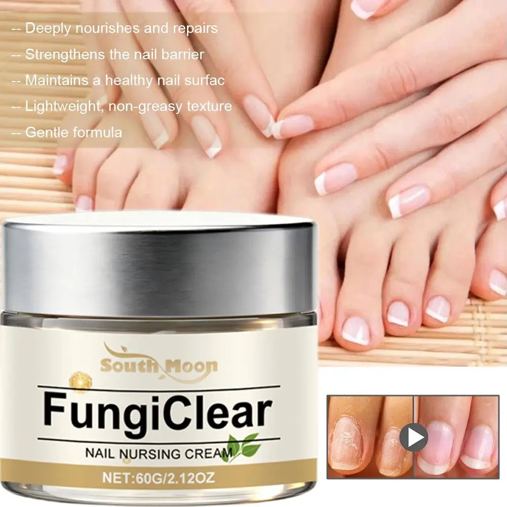 Nail Nursing Cream – Fungi Clear & Nourishing Daily Nail Care | Oregano, Tea Tree & Vitamin E