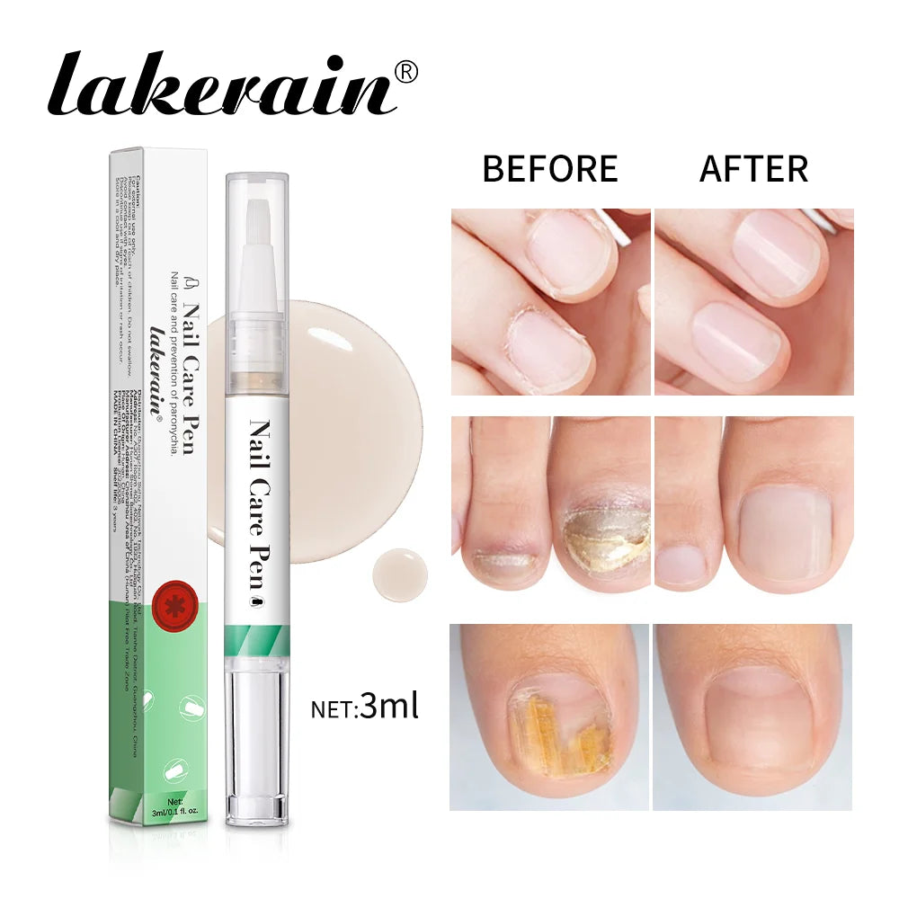Eleeles Nail Care Pen – Cuticle Oil with Flat Brush, Nourishing & Anti-Fungal 3ml