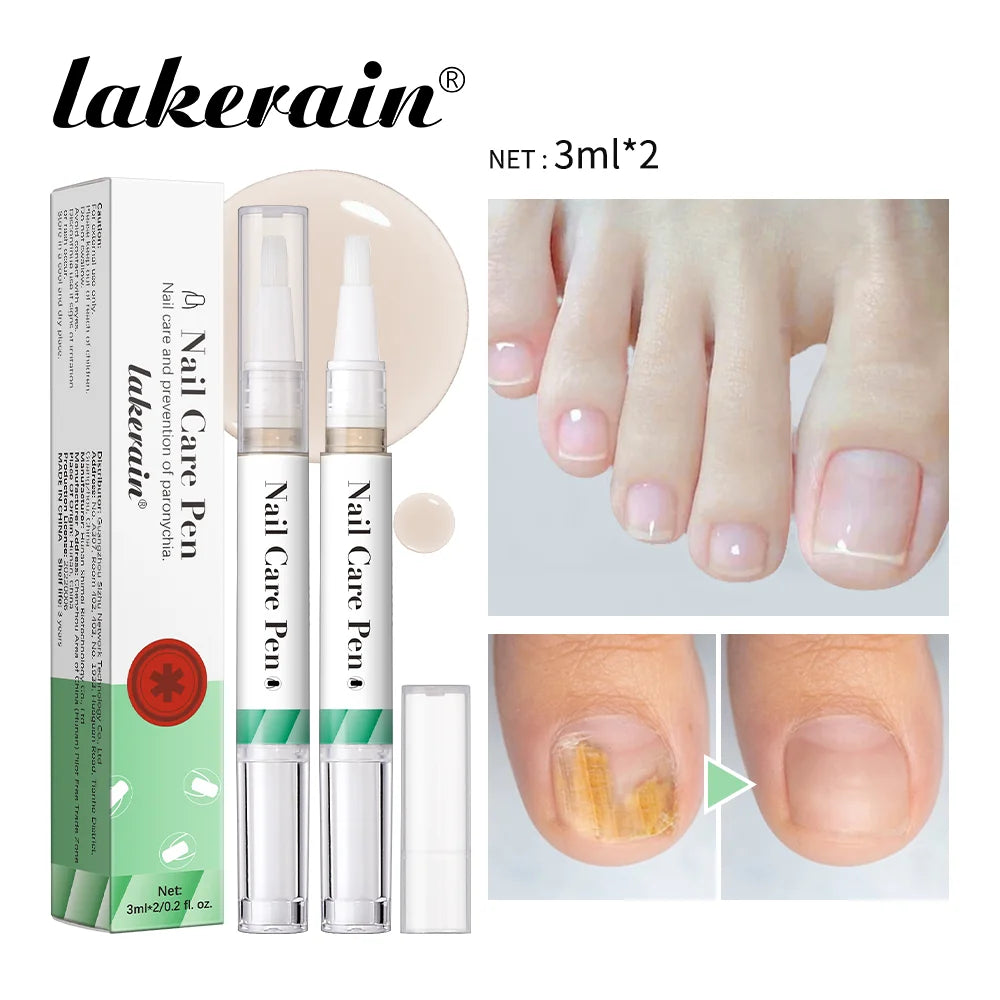 Eleeles Nail Care Pen – Cuticle Oil with Flat Brush, Nourishing & Anti-Fungal 3ml