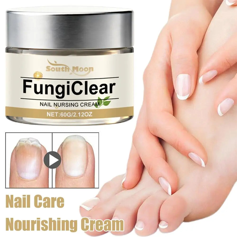 Nail Nursing Cream – Fungi Clear & Nourishing Daily Nail Care | Oregano, Tea Tree & Vitamin E