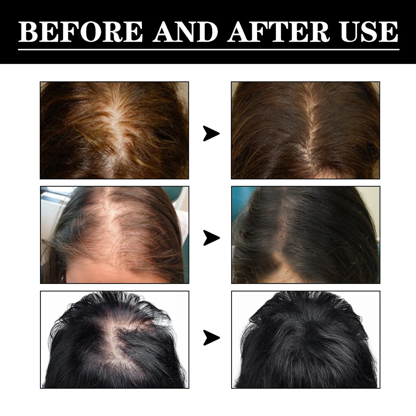Eleeles Scalp Nourishing Hair Growth Serum – Panthenol, Glycerin & PCA Sodium | 29ml
