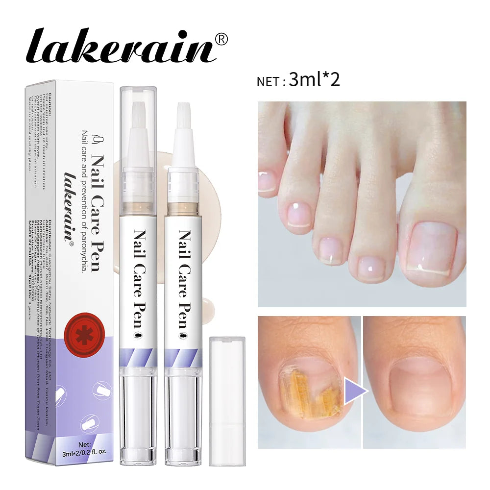 Eleeles Nail Care Pen – Cuticle Oil with Flat Brush, Nourishing & Anti-Fungal 3ml
