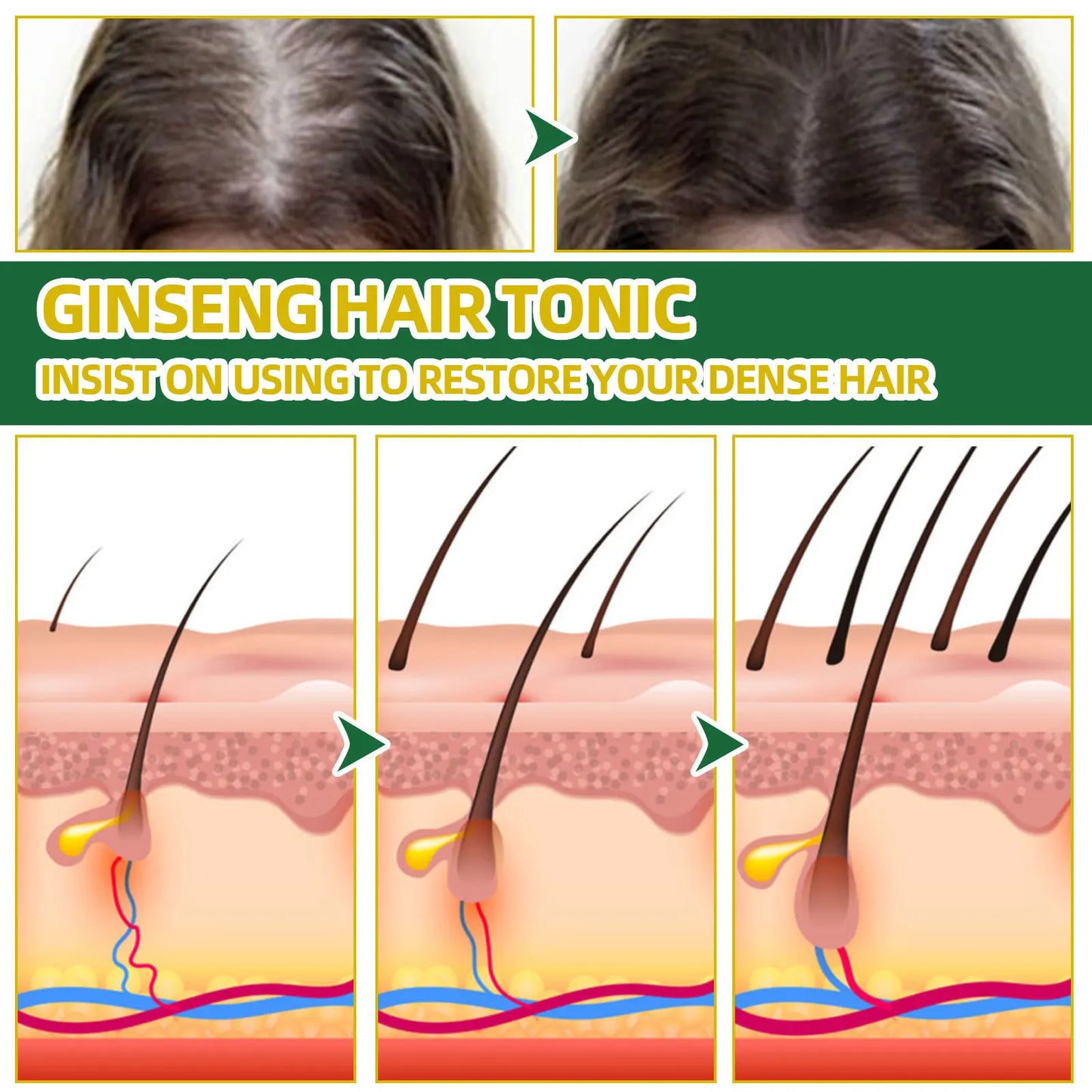 Eleeles Ginseng Hair Tonic Spray – Anti Hair Loss, Scalp Nourishment & Growth Serum