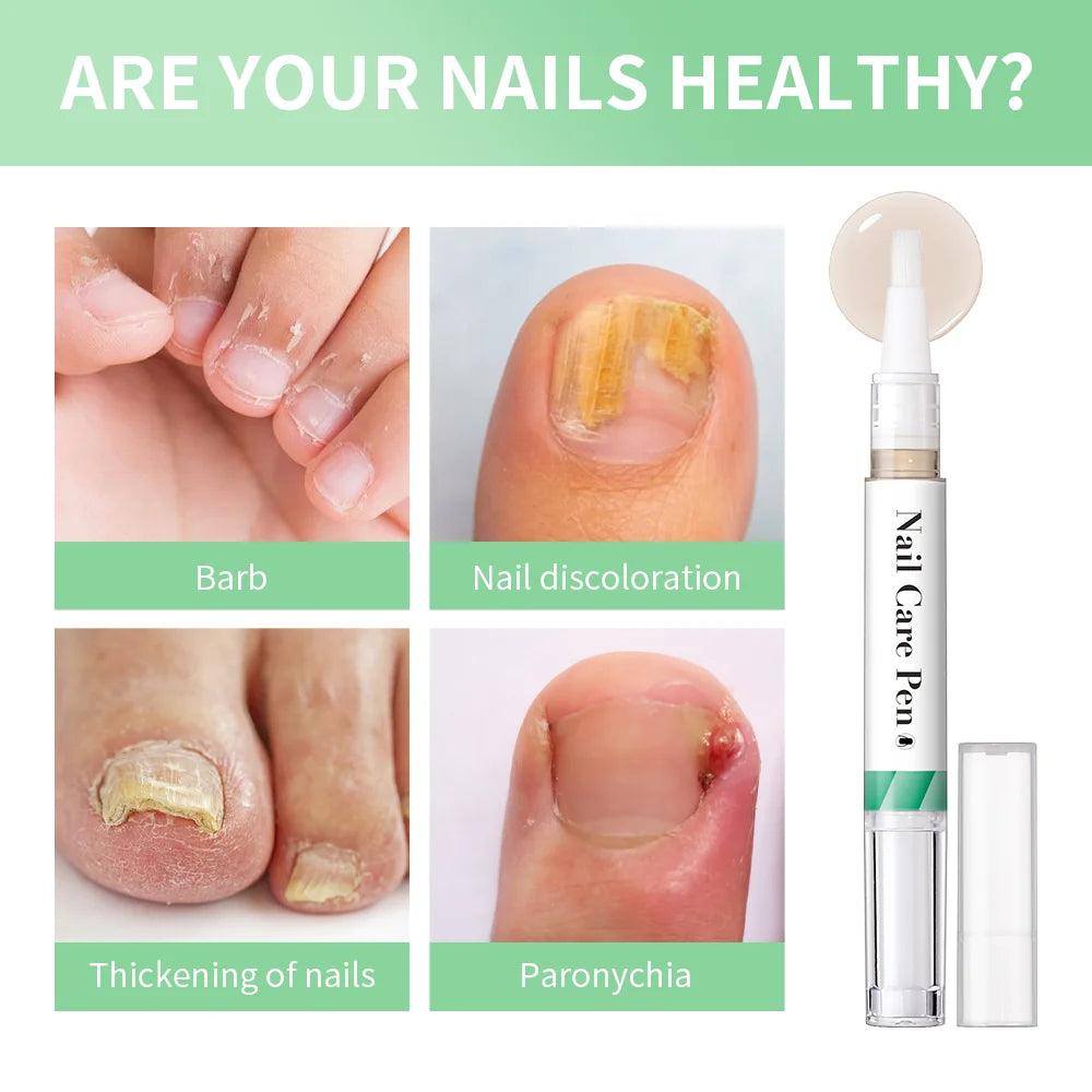 Eleeles Nail Care Pen – Cuticle Oil with Flat Brush, Nourishing & Anti-Fungal 3ml