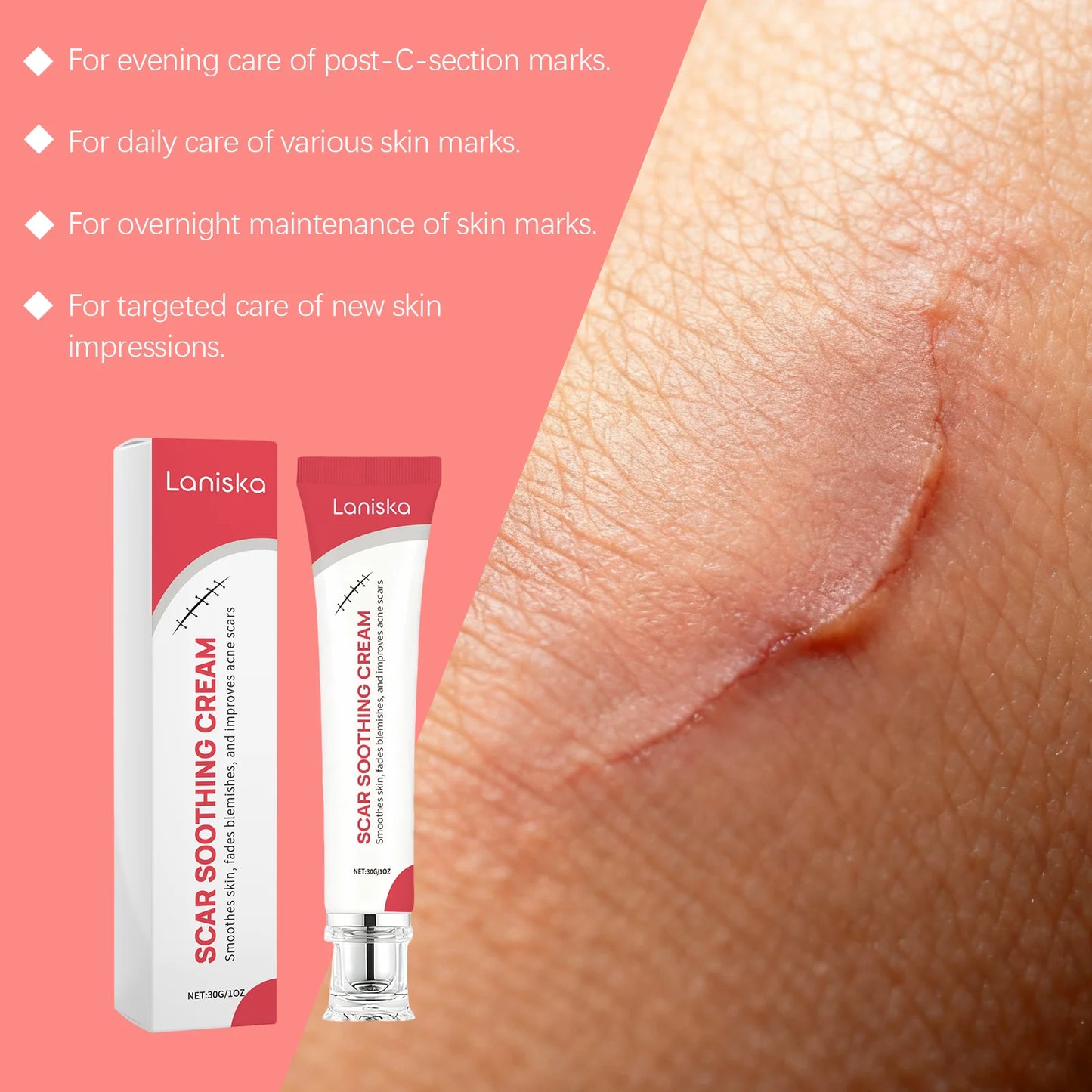 Skin Care Cream Gentle Nourishing Smooth Care for Soft Body Skin Daily Care Cream