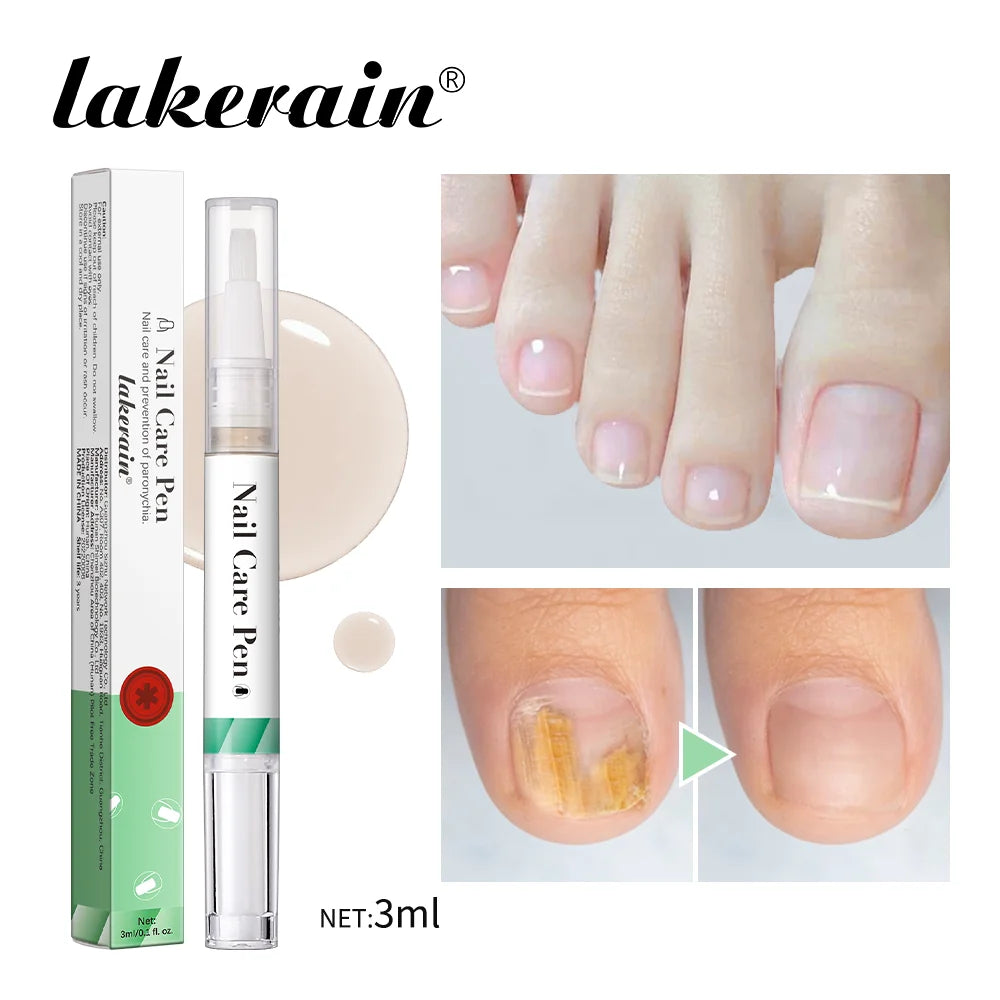 Eleeles Nail Care Pen – Cuticle Oil with Flat Brush, Nourishing & Anti-Fungal 3ml