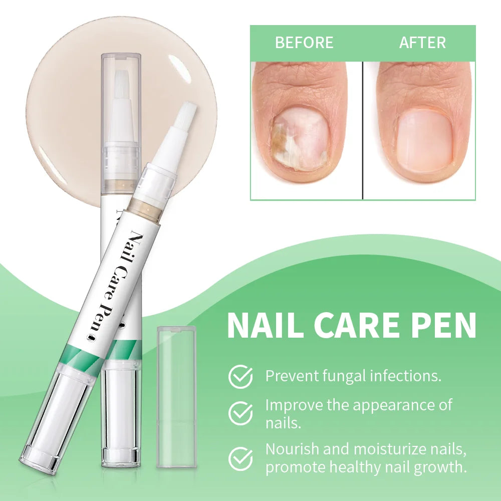 Eleeles Nail Care Pen – Cuticle Oil with Flat Brush, Nourishing & Anti-Fungal 3ml