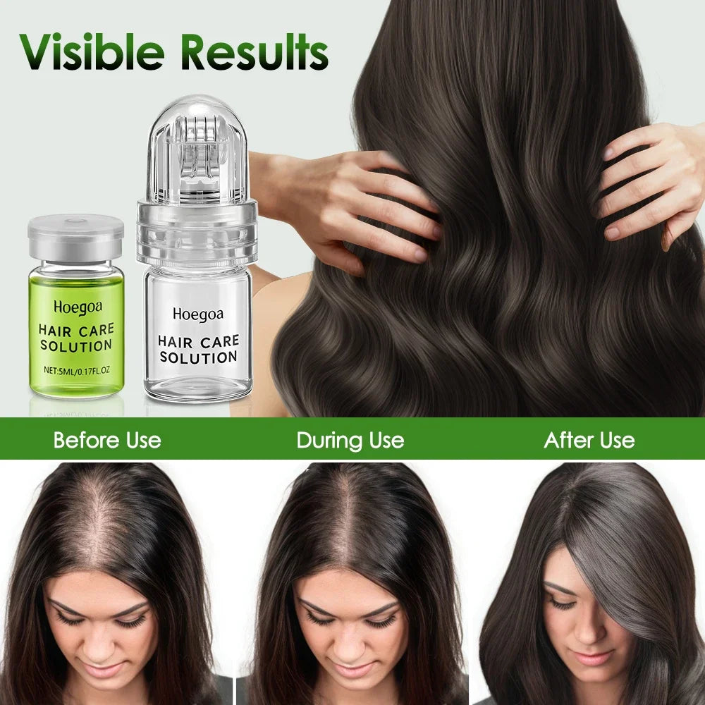 1/2/3 Boxes Hair Essential Care Serum strengthen roots Reducing Loss Prevent Baldness Nourishing Regrow Hair Care Essence