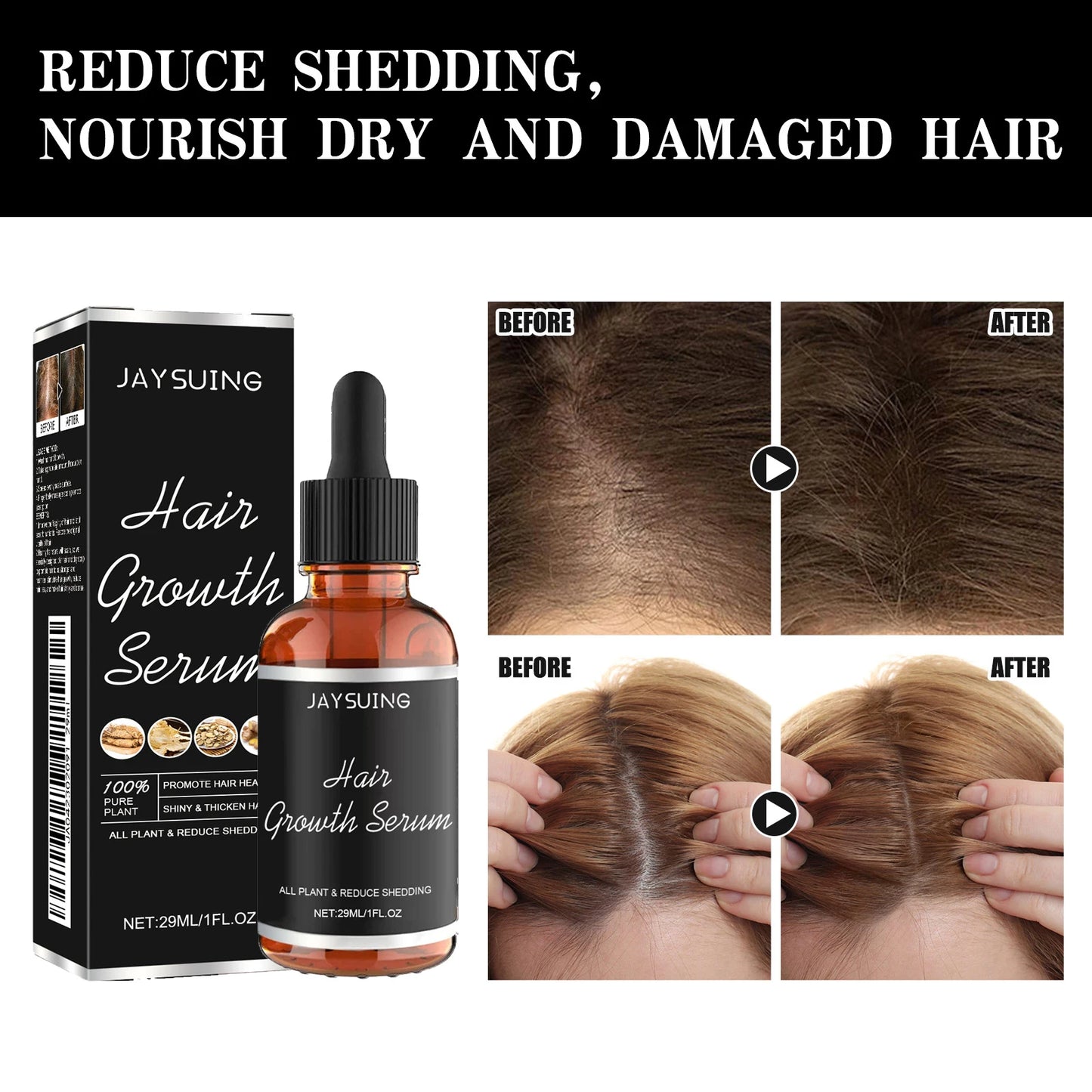 Eleeles Scalp Nourishing Hair Growth Serum – Panthenol, Glycerin & PCA Sodium | 29ml
