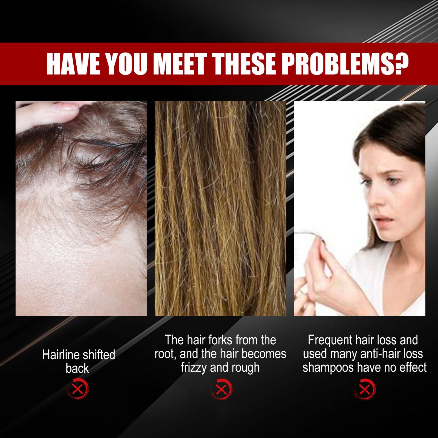 Black Rice Hair Growth Spray - Ginger & Ginseng Scalp Treatment