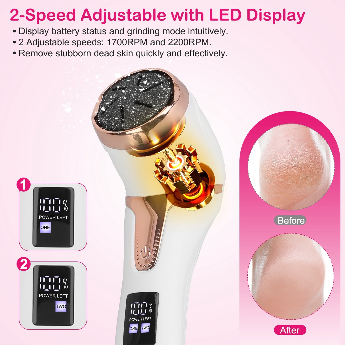 Professional Electric Foot Callus Remover - 17-Piece Pedicure Kit hand roller
