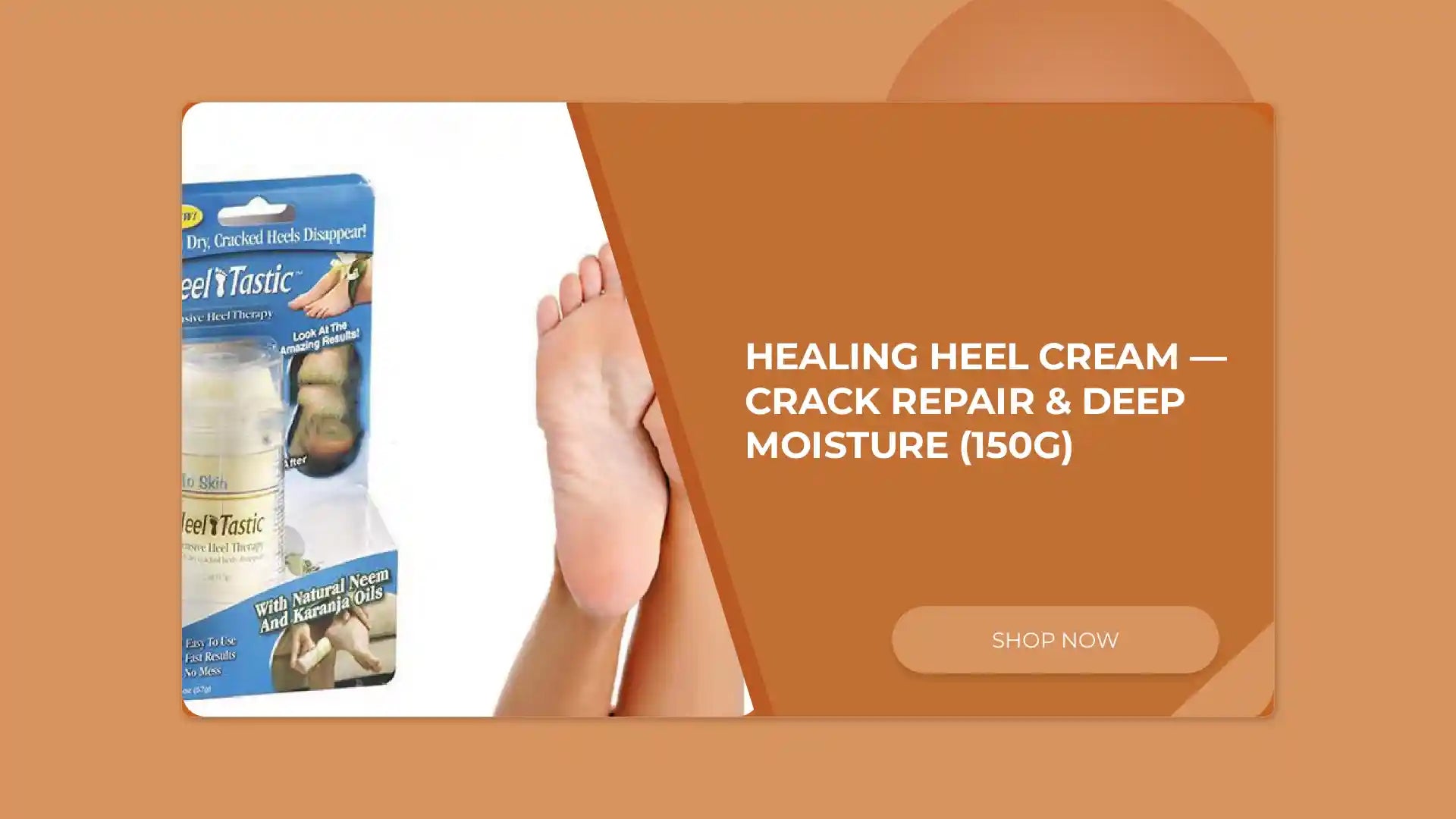 Healing Heel Cream &mdash; Crack Repair & Deep Moisture (150g) by@Outfy